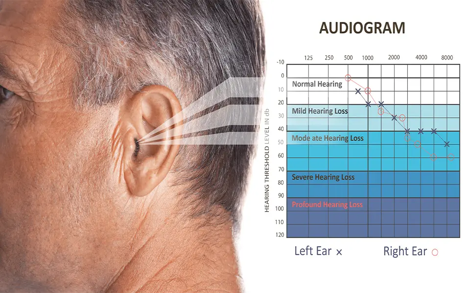 Audiogram Report
Adult Hearing Examination